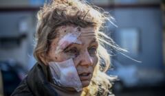 Kobieta z ranami na twarzy i opatrunkami